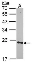 Anti-CRIP2 antibody [N1C3] used in Western Blot (WB). GTX114340