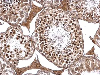Anti-DRIL1 antibody used in IHC (Paraffin sections) (IHC-P). GTX114367