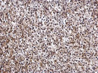 Anti-DRIL1 antibody used in IHC (Paraffin sections) (IHC-P). GTX114367