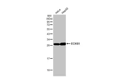 Anti-ECHS1 antibody used in Western Blot (WB). GTX114375