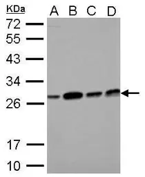 Anti-ECHS1 antibody used in Western Blot (WB). GTX114375