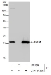 Anti-ECHS1 antibody [N1C2] used in Immunoprecipitation (IP). GTX114376