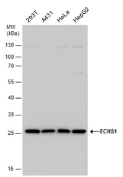 Anti-ECHS1 antibody [N1C2] used in Western Blot (WB). GTX114376
