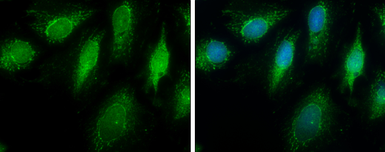 Anti-ECHS1 antibody [N1C2] used in Immunocytochemistry/ Immunofluorescence (ICC/IF). GTX114376