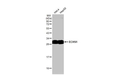 Anti-ECHS1 antibody [N1C2] used in Western Blot (WB). GTX114376