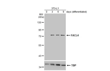 Anti-FACL4 antibody [N1N3] used in Western Blot (WB). GTX114399