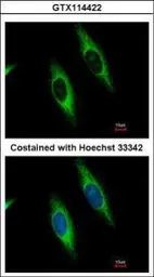 Anti-GART antibody [N1N2], N-term used in Immunocytochemistry/ Immunofluorescence (ICC/IF). GTX114422