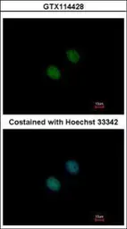Anti-GCN5 antibody [C2C3], C-term used in Immunocytochemistry/ Immunofluorescence (ICC/IF). GTX114428
