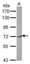 Anti-TFIIF antibody used in Western Blot (WB). GTX114455