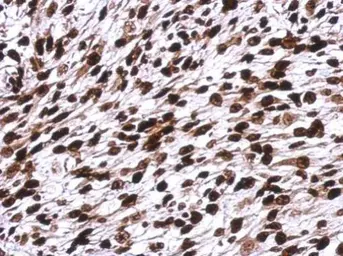 Anti-Histone H1.0 antibody used in IHC (Paraffin sections) (IHC-P). GTX114462