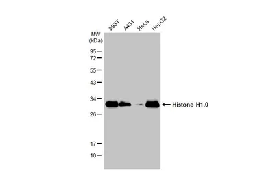 Anti-Histone H1.0 antibody used in Western Blot (WB). GTX114462