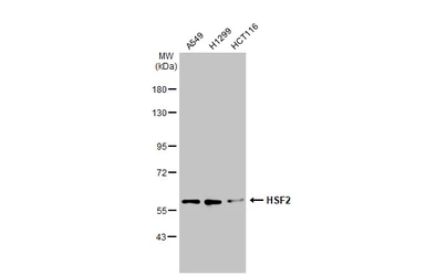 Anti-HSF2 antibody [N1N3] used in Western Blot (WB). GTX114481