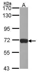 Anti-L-Plastin antibody [C1C3] used in Western Blot (WB). GTX114524
