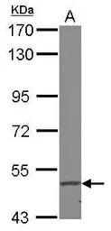 Anti-FADS1 antibody used in Western Blot (WB). GTX114528
