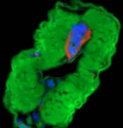 Anti-LOXL1 antibody used in IHC (Whole mount) (IHC-Wm). GTX114532