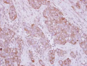 Anti-NBR1 antibody used in IHC (Paraffin sections) (IHC-P). GTX114539