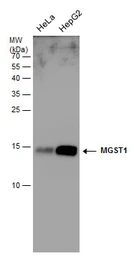 Anti-MGST1 antibody used in Western Blot (WB). GTX114551