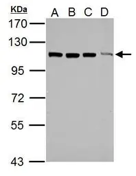 Anti-TRIM37 antibody [N1N2], N-term used in Western Blot (WB). GTX114565