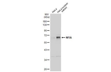 Anti-NFIA antibody used in Western Blot (WB). GTX114580