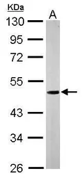 Anti-Nucleobindin 1 antibody [N3C3] used in Western Blot (WB). GTX114593