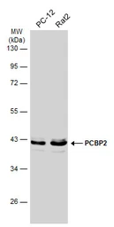 Anti-PCBP2 antibody [N1C1] used in Western Blot (WB). GTX114616