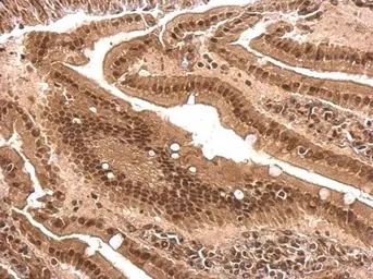 Anti-PCBP2 antibody [N1C1] used in IHC (Paraffin sections) (IHC-P). GTX114616