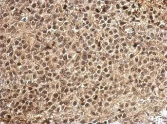Anti-PCBP2 antibody used in IHC (Paraffin sections) (IHC-P). GTX114617