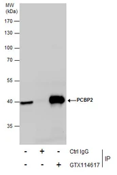 Anti-PCBP2 antibody used in Immunoprecipitation (IP). GTX114617