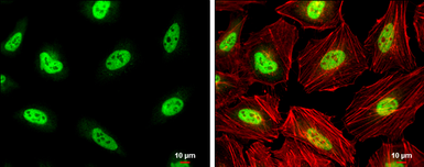 Anti-PCBP2 antibody used in Immunocytochemistry/ Immunofluorescence (ICC/IF). GTX114617
