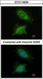 Anti-PGM3 antibody [N1C1] used in Immunocytochemistry/ Immunofluorescence (ICC/IF). GTX114634