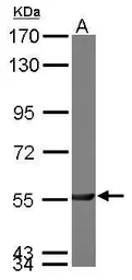 Anti-PGM3 antibody [N1C1] used in Western Blot (WB). GTX114634