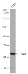 Anti-Brn2 antibody used in Western Blot (WB). GTX114650