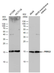 Anti-PRRG2 antibody used in Western Blot (WB). GTX114668