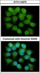 Anti-PSMC4 antibody used in Immunocytochemistry/ Immunofluorescence (ICC/IF). GTX114675