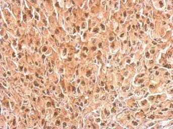 Anti-PSMC4 antibody used in IHC (Paraffin sections) (IHC-P). GTX114675