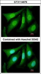 Anti-PSMC5 antibody used in Immunocytochemistry/ Immunofluorescence (ICC/IF). GTX114676