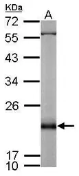 Anti-RAP2B antibody used in Western Blot (WB). GTX114702