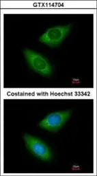Anti-Arginyl tRNA synthetase antibody [N2C2], Internal used in Immunocytochemistry/ Immunofluorescence (ICC/IF). GTX114704