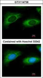 Anti-RPL9 antibody used in Immunocytochemistry/ Immunofluorescence (ICC/IF). GTX114728