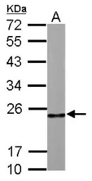 Anti-RPL9 antibody used in Western Blot (WB). GTX114728