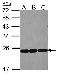 Anti-RPL9 antibody used in Western Blot (WB). GTX114728