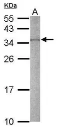 Anti-RPS2 antibody [N2C3] used in Western Blot (WB). GTX114734