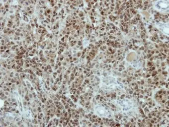 Anti-TRA2B antibody used in IHC (Paraffin sections) (IHC-P). GTX114752