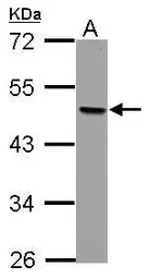 Anti-AP2 beta antibody used in Western Blot (WB). GTX114832