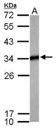 Anti-Tropomyosin 4 antibody used in Western Blot (WB). GTX114851