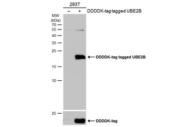 Anti-UBE2B antibody used in Western Blot (WB). GTX114867