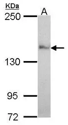 Anti-Nardilysin antibody [C2C3], C-term used in Western Blot (WB). GTX114899