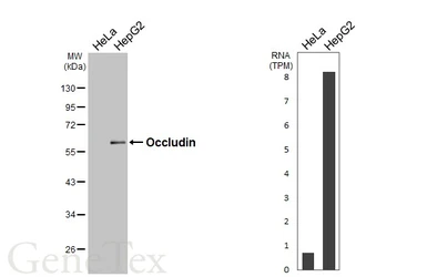 Anti-Occludin antibody used in Western Blot (WB). GTX114949