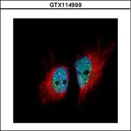 Anti-hnRNP M antibody [N1N2], N-term used in Immunocytochemistry/ Immunofluorescence (ICC/IF). GTX114999