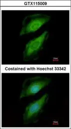 Anti-PLCD1 antibody [C1C3] used in Immunocytochemistry/ Immunofluorescence (ICC/IF). GTX115009
